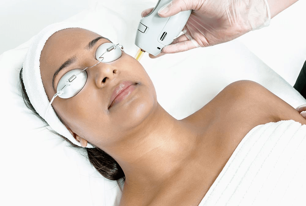 Spider vein removal with Nd:YAG laser — Hollywood FL